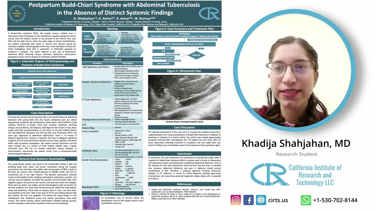 Postpartum Budd-Chiari Syndrome with Abdominal Tuberculosis- Khadija Shahjahan, MD