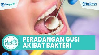 Apakah Bakteri pada Karang Gigi Dapat Memicu Peradangan Gusi? Simak Ulasan drg. Aprilia Denta