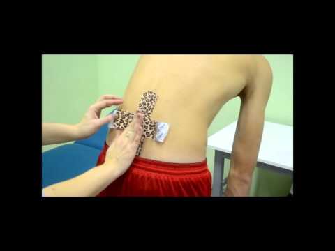 Повышенное накопление рфп в грудном отделе Актовегин болит спина
