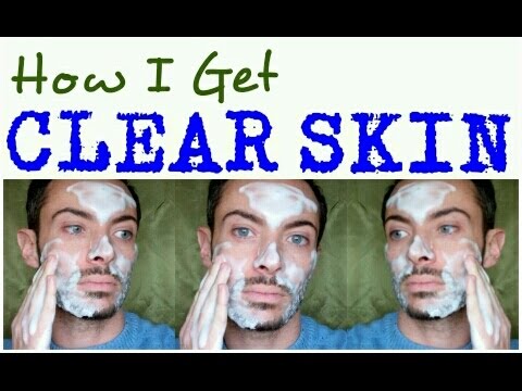 HOW I GET ACNE FREE, CLEAR SKIN | Natural DIY | Cheap Tip #200