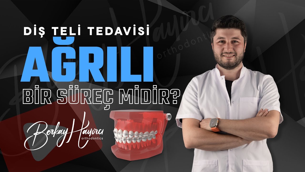 Diş Teli Tedavisi Ağrılı Bir Süreç Midir?