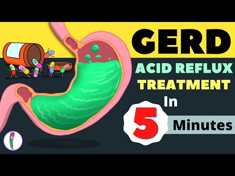 GERD Treatment | Acid Reflux Treatment | Heartburn Treatment - All You Need to Know