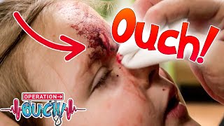 Scabs and Scars!  🩸 🤕 | Science for Kids | Full Episodes | Operation Ouch