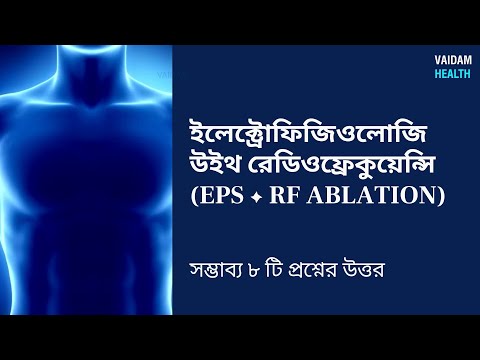 ইপিএস আরএফ অপসারণ - ৮ টি প্রায়শই জিজ্ঞাসিত প্রশ্ন