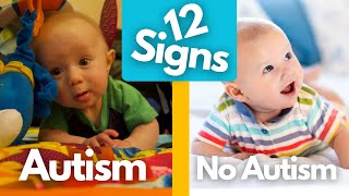 12 Early Signs of Autism in Infants, You Might Miss