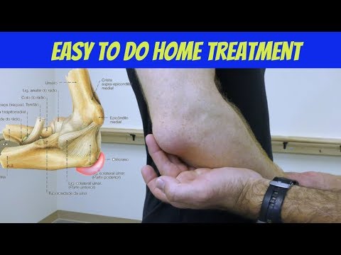 Ellbogen-Bursitis-Behandlung zu Hause - So behandeln Sie Olecranon-Bursitis