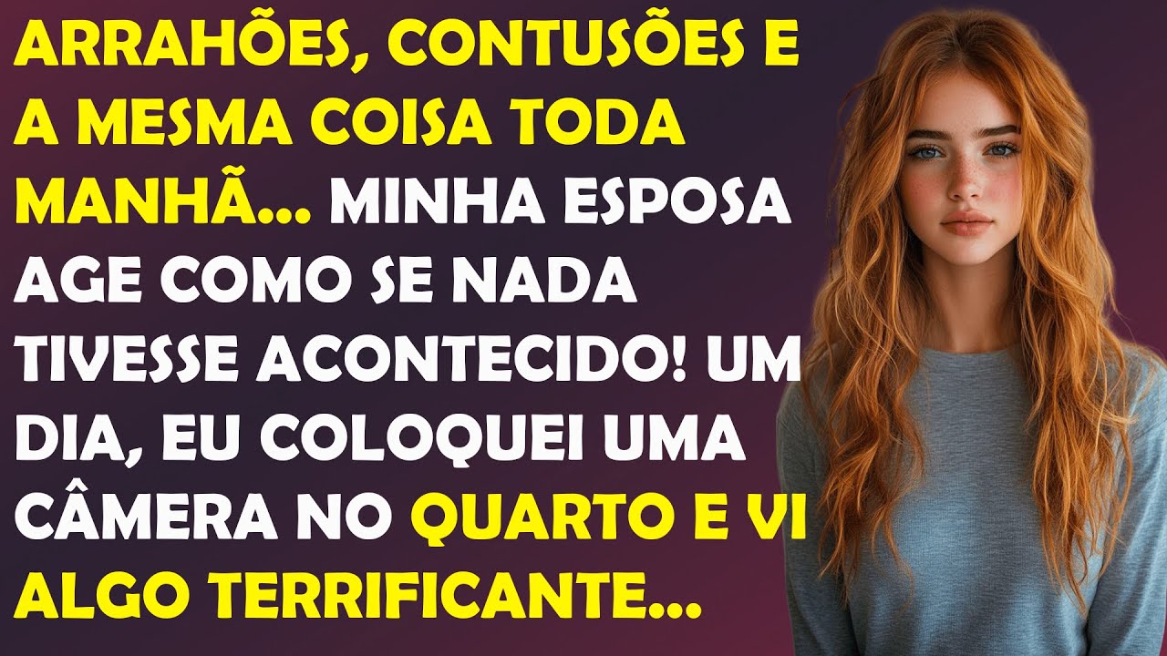 Toda manhã eu acordo com cicatrizes no corpo! Mas minha esposa finge que elas não estão lá...