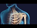 Reverse Shoulder Replacement Surgery