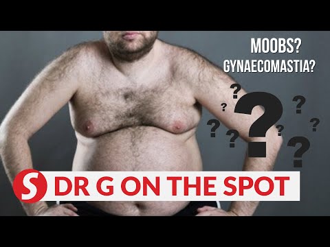 EP39: “Man boobs” (gynaecomastia) | PUTTING DR G ON THE SPOT