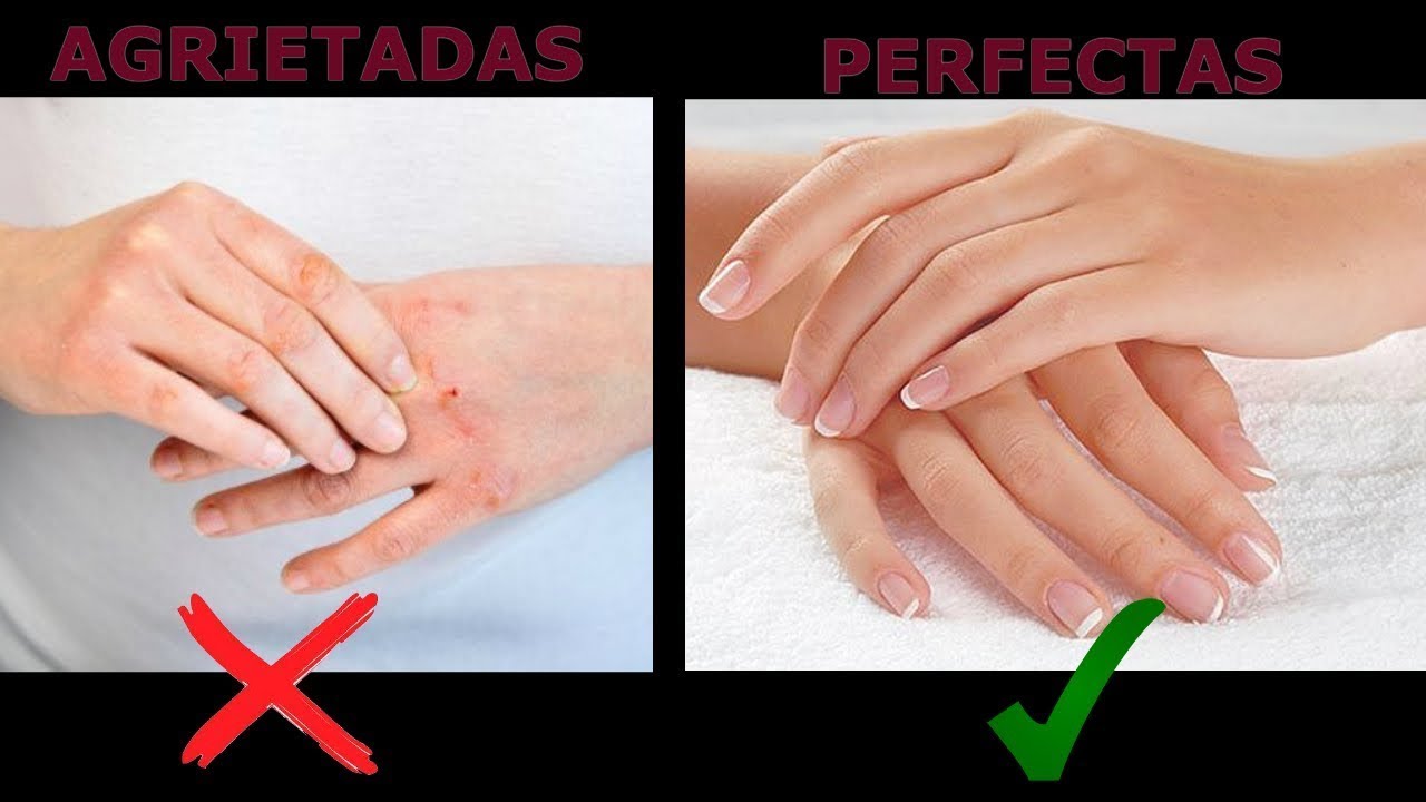 Watch Manos Agrietadas por el Frío NO MAS!! | 5 Tips para tener unas manos PERFECTAS en Invierno Now Manos Agrietadas por el Frío NO MAS!! | 5 Tips para tener unas manos PERFECTAS en Invierno