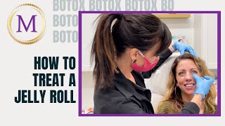 How to Treat A Jelly Roll using Botox