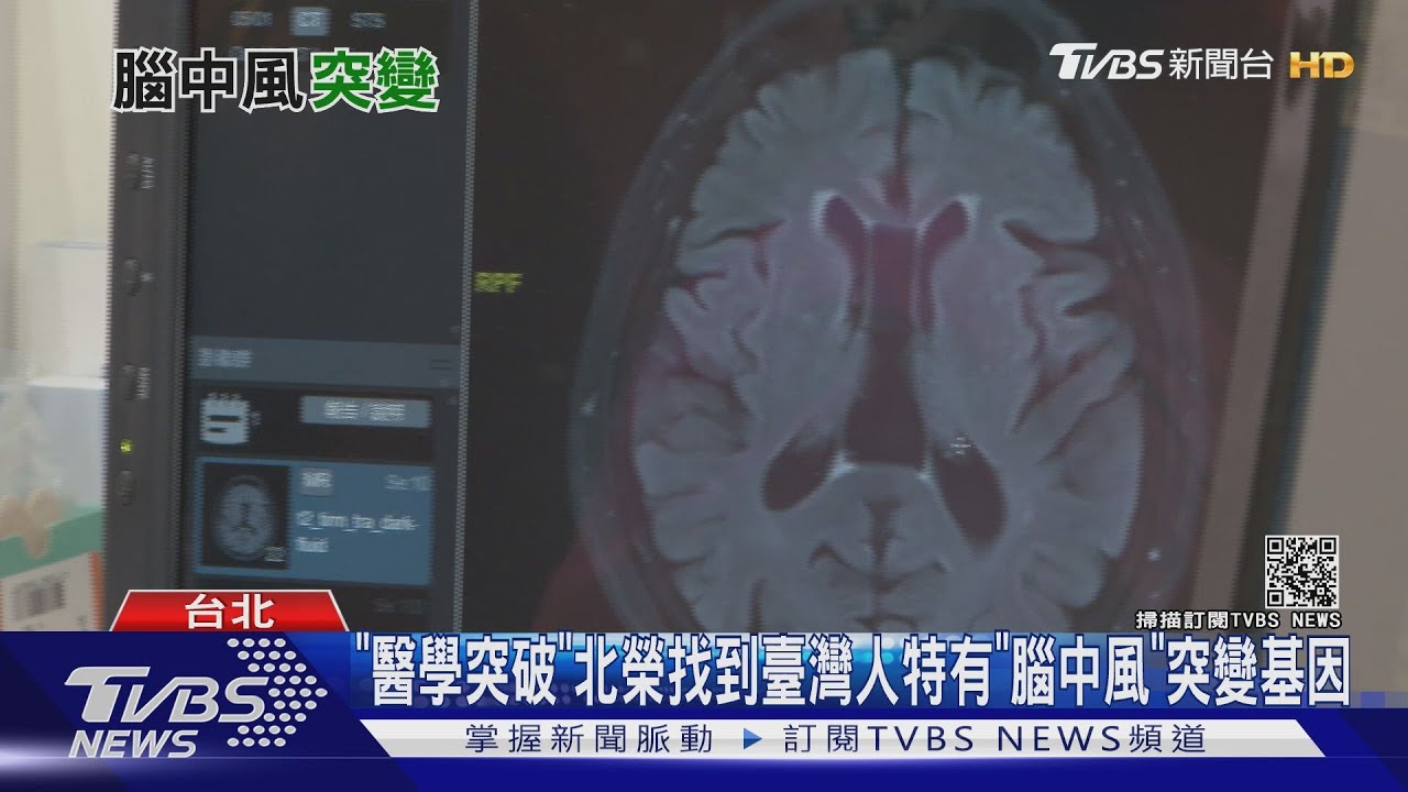 北榮找到台灣人特有「腦中風」突變基因　這種人要注意！
