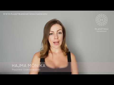 Plasztikai Szaktanácsadás - Képgaléria