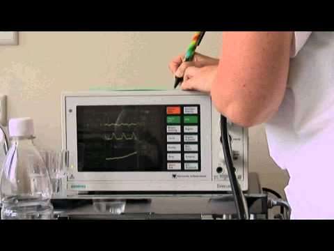 "Bis ans Ende" - ein Film von Susanna Wüstneck - Trailer