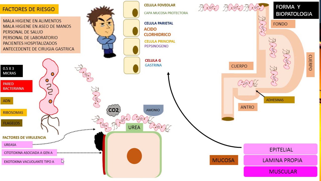Helicobacter  PYLORI duodenitis