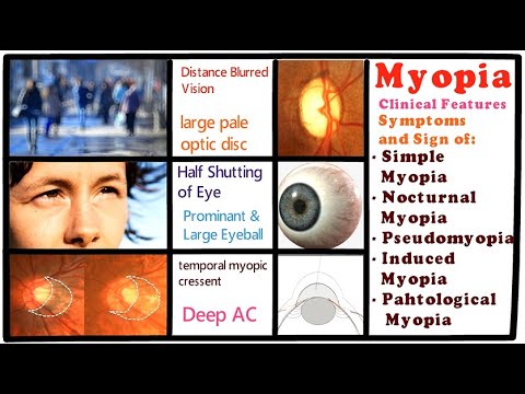 A demodikózis befolyásolja a látást