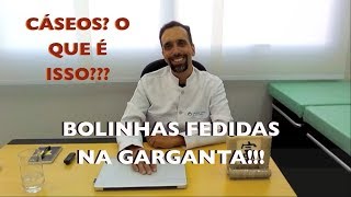 Você sabe o que são cáseos?