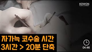 코원성형외과 코성형 자가늑연골 실제 채취 수술영상