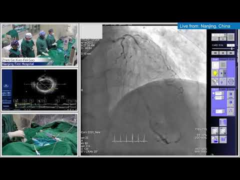 Intravascular Imaging Guided PCI with IVUS (Treatment of LM Bifurcation Lesion)