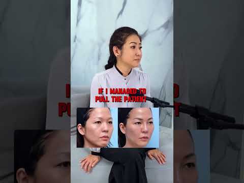 Can Sculptra Make You Look 10 Years Younger? | Real Anti-Ageing Results in Malaysia