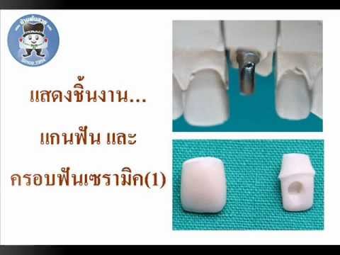 สีบลอนด์ที่มีหน้าอกขนาดเล็กโป๊ฟรี สาวชุดแต่งงานหน้าอกเล็ก