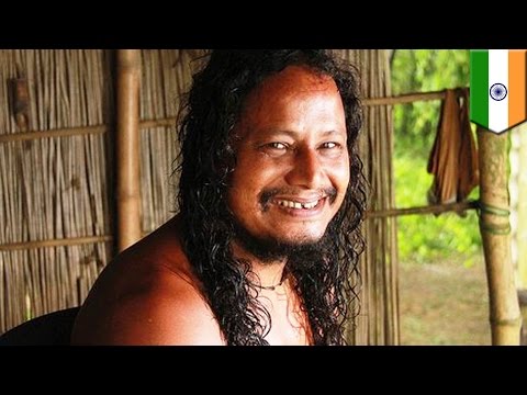 Rare skin condition makes man’s skin so sensitive wearing clothing hurts - TomoNews