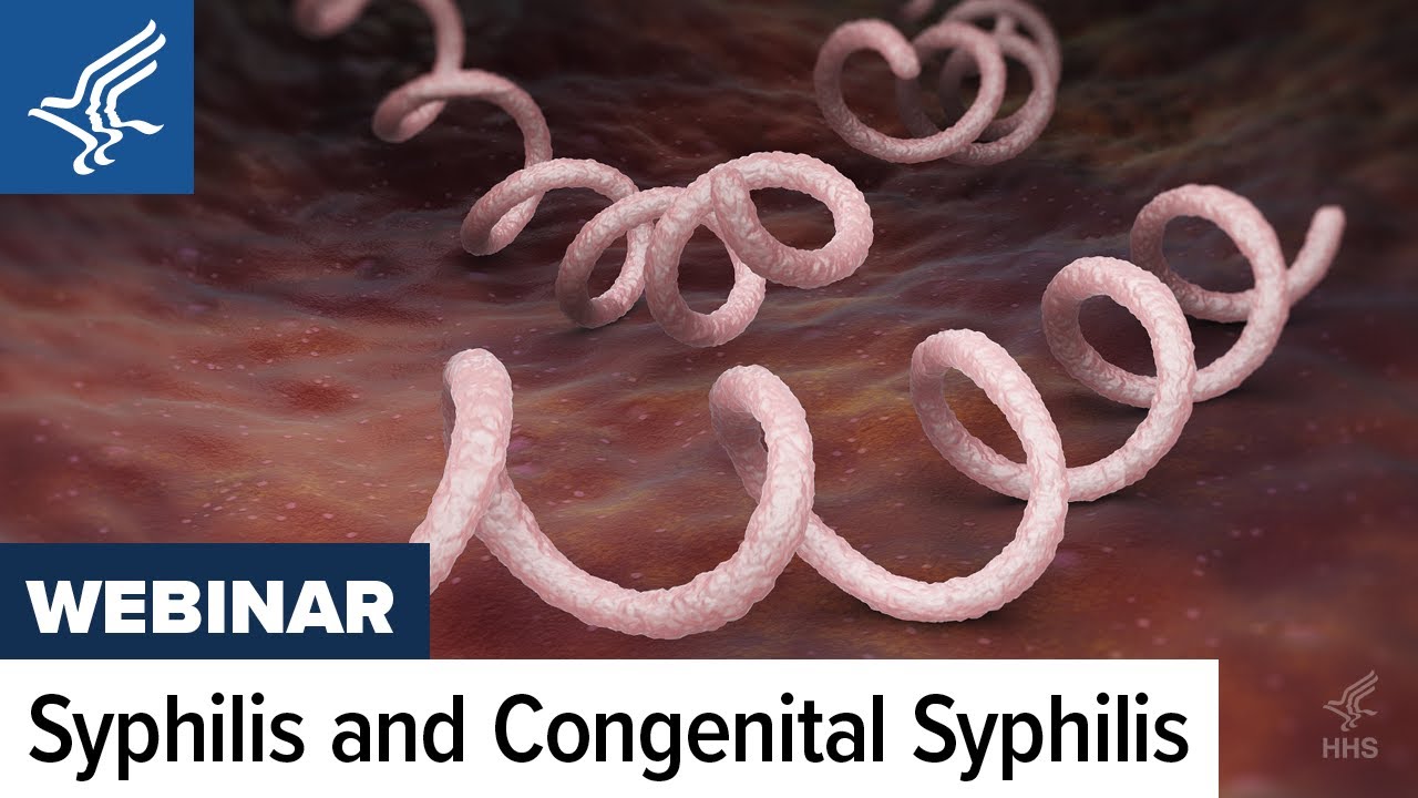 Stopping Syphilis: the HHS Summer Seminar Series-The Top 10 List for Moving Forward