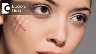 How to get rid of scars on face? - Dr. Aruna Prasad