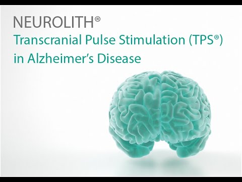 Transcranial Pulse Stimulation – A modern therapeutic procedure for treating Alzheimer’s symptoms