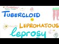 Tuberculoid Leprosy vs Lepromatous Leprosy | Comparisons Playlist