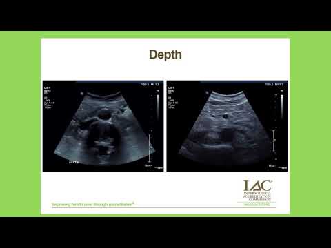 Image Optimization, a webcast by IAC Vascular Testing.