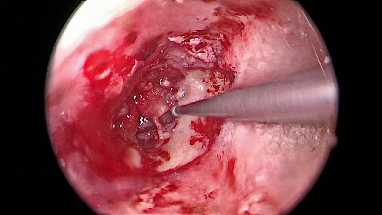 Luiz Henrique Chequim-10
