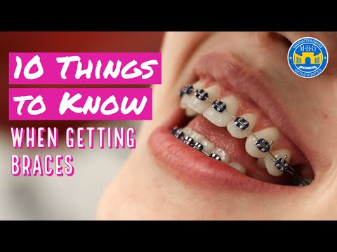 10 Things to Know When Getting Braces