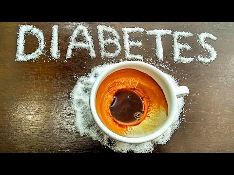Menú para diabéticos Aeroflot AMF sobre la diabetes
