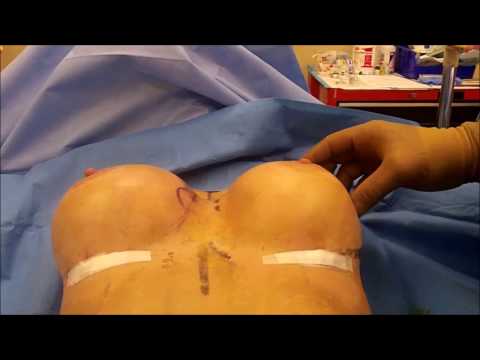 download lagu mp3 mp4 Uniboob, download lagu Uniboob gratis, unduh video klip Download Uniboob Mp3 dan Mp4 Popular Gratis