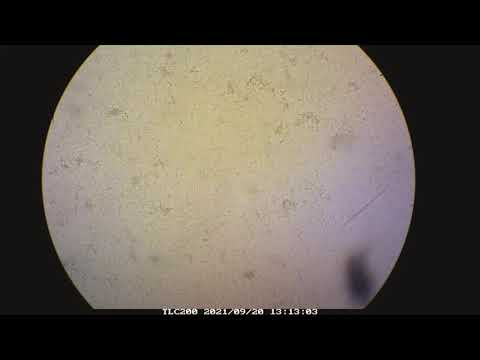 Watch Bacteria Grow Timelapse