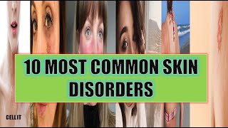 10 MOST COMMON SKIN DISORDERS(DISEASES) IN HUMANS
