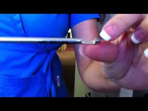 TAMIS:  Technical details of how to use the LSI Device (for surgical techs & CR Surgeons)