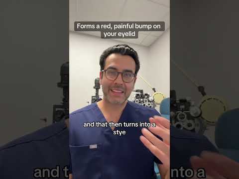Get rid of styes fast!