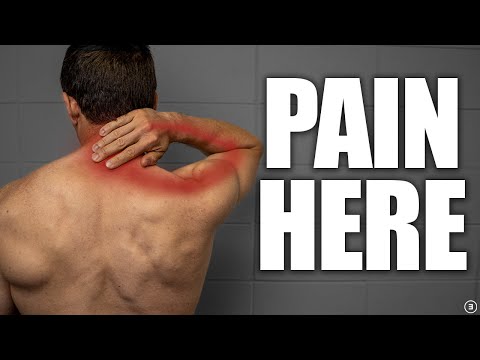 Cervical Radiculopathy | “Pinched” Nerve in Neck Rehab (Education | Exercises | Surgery | Myths)