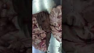 Gross BRAIN-post-embalmed AUTOPSY