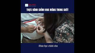 [Học chỉnh nha] - Thực hành chỉnh nha máng trong suốt. #niengrang #tintuc #nhakhoa #dainha #dentist