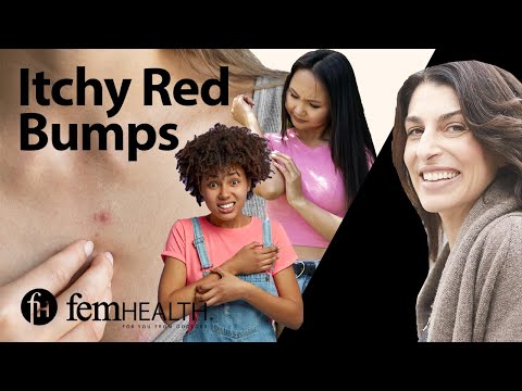 Dermatologist breaks down 7 causes of red itchy bumps | What your rash might be??