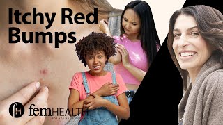 Dermatologist breaks down 7 causes of red itchy bumps | What your rash might be??