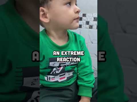 Weird Medical Conditions - Hyperekplexia