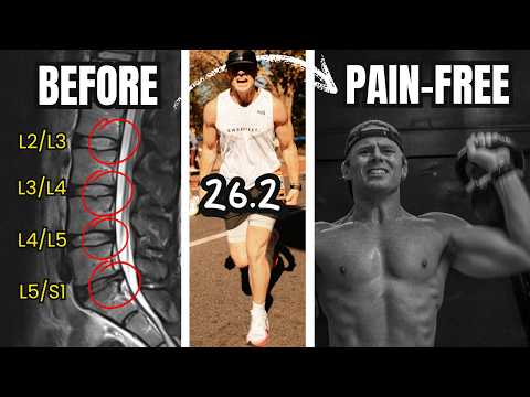 Healing 3 Disc Bulges & 1 Herniation to Running a 3:05 Marathon & HYROX Pain-Free  — 8 week rehab