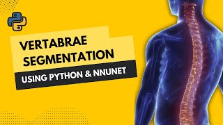 Download the video "Vertabrae Segmentation using Python and nnUNetv2"