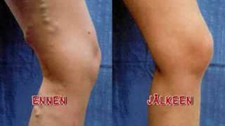 Hassisen Kone - Jeesus tulee