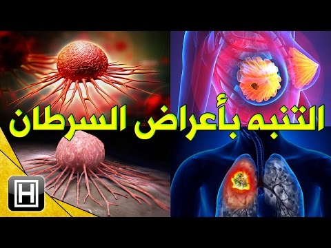 تعرف على اعراض السرطان العامة التي يجب على كل فرد بالغ التنبه بها ومعرفتها