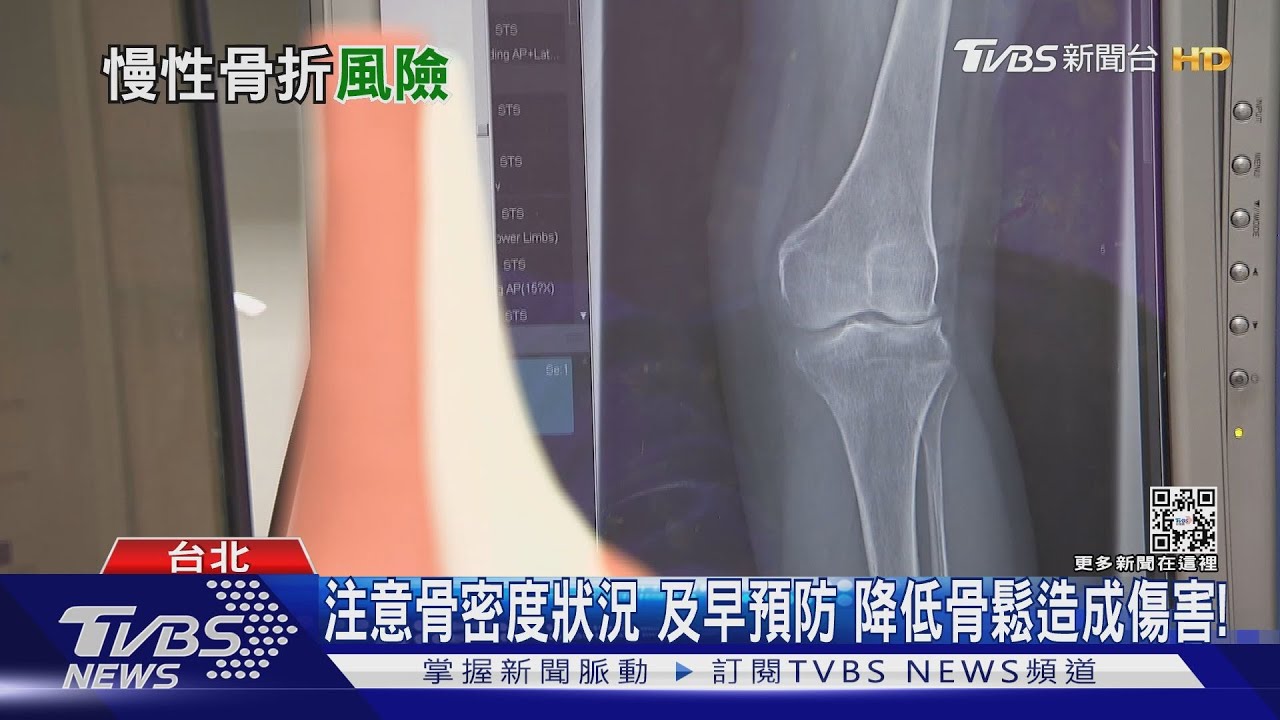 罹「這幾種疾病」者...骨質疏鬆風險高 醫師:小心跌倒......
